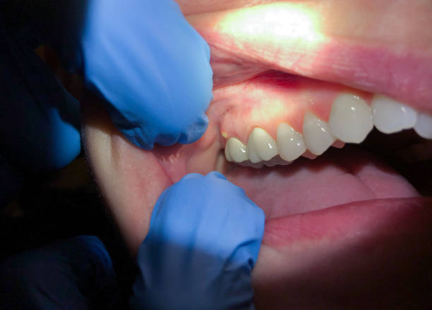 Best Broken Tooth Emergency  in Lacon, IL